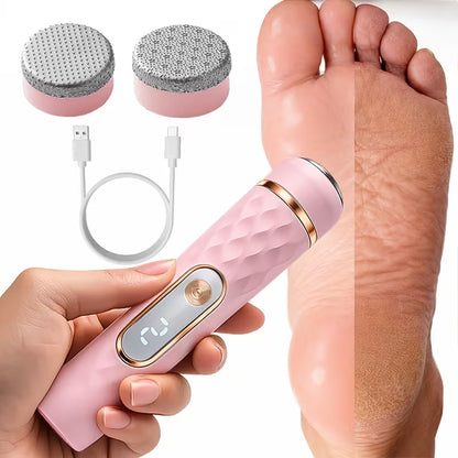 VenusVelvet™  Foot Callus Remover