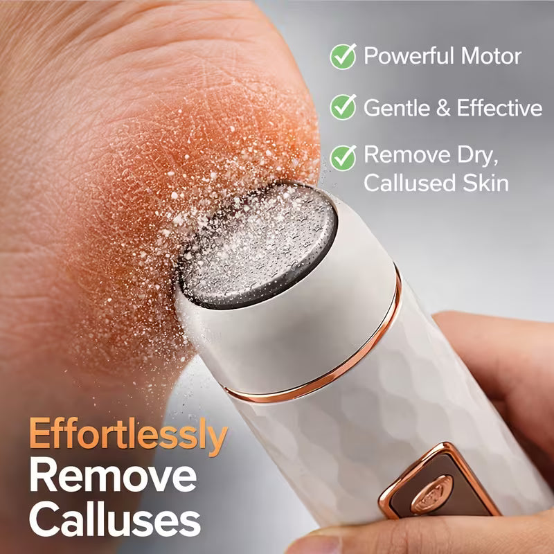 VenusVelvet™  Foot Callus Remover
