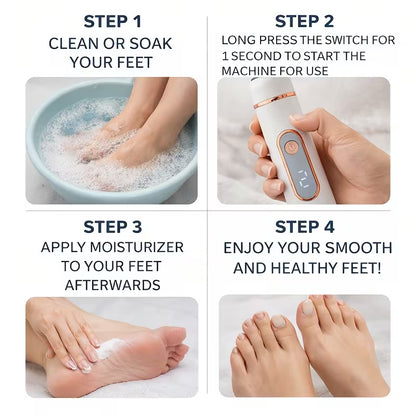 VenusVelvet™  Foot Callus Remover